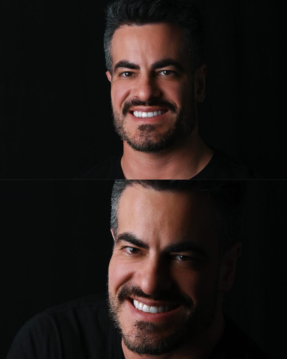 Sorriso transformado — L'avance