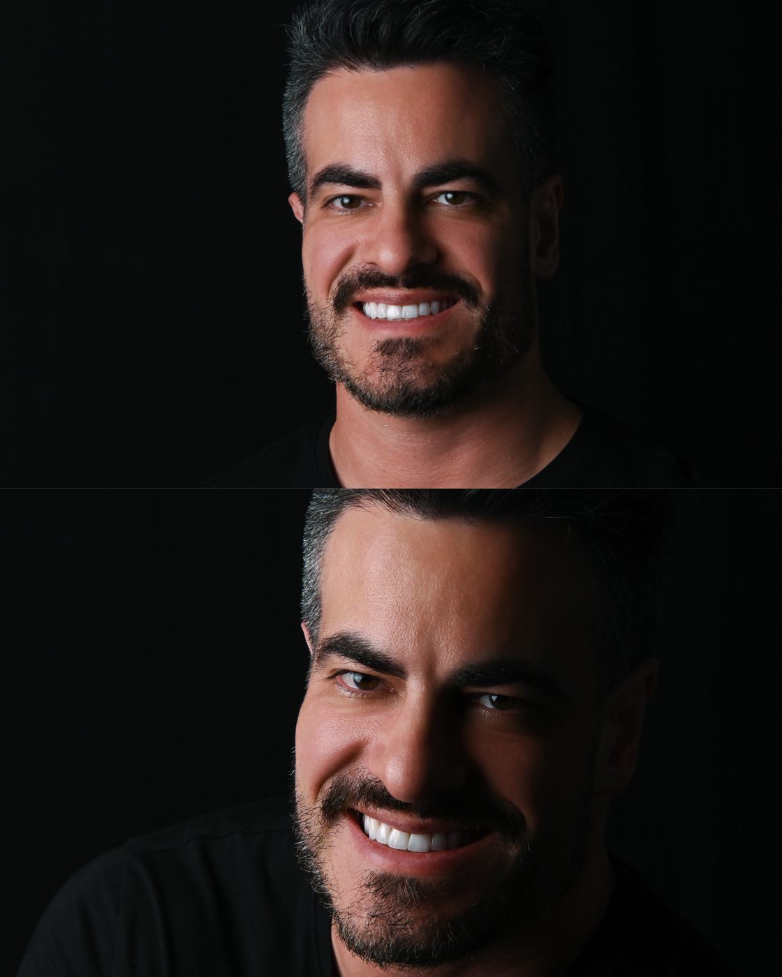 Paciente sorrindo após o Sorriso L'avance